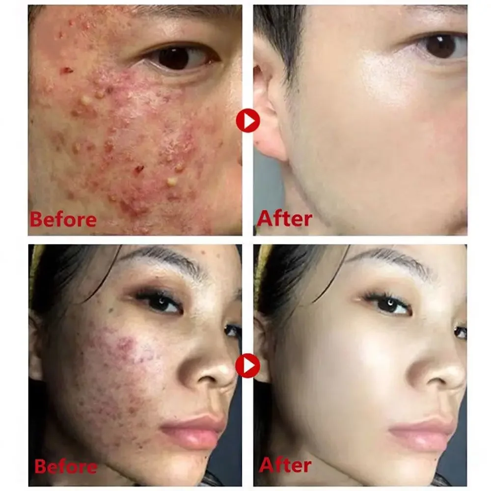 Bâton de masque au thé vert, é - Green Tea Cleansing Clay Mask avis et prix